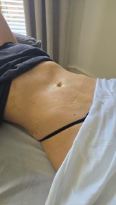 mld massage therapist