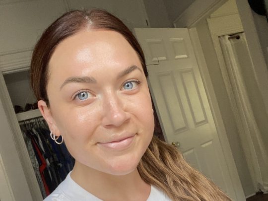 microneedling benefits